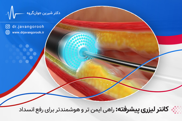 کاتتر لیزری پیشرفته: راهی ایمن‌تر و هوشمندتر برای رفع انسداد شریان‌ها